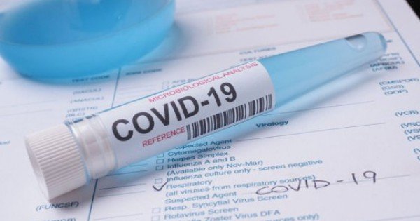 689 de cazuri noi de COVID – 19. Alți 28 de moldoveni au murit în urma complicațiilor provocate de coronavirus