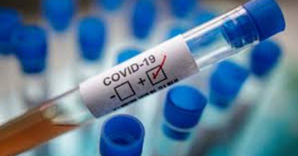 Trei decese și 92 de cazuri noi de infectare cu COVID-19 au fost confirmate astăzi în R. Moldova
