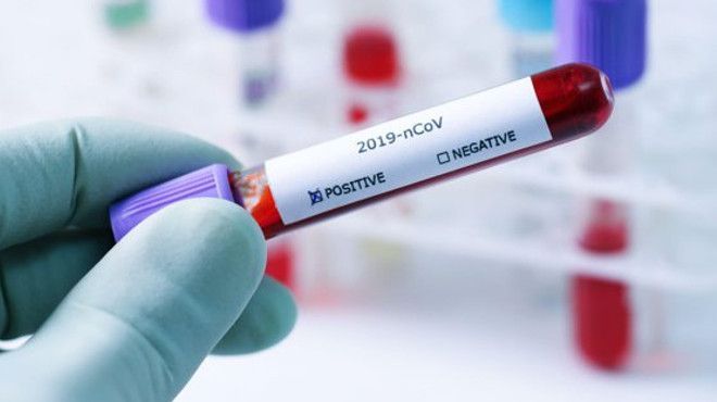 80 la suta dintre moldovenii care s-au infectat cu noul coronavirus nu sunt vaccinați